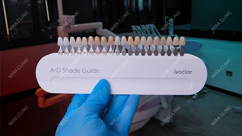 Shade selection